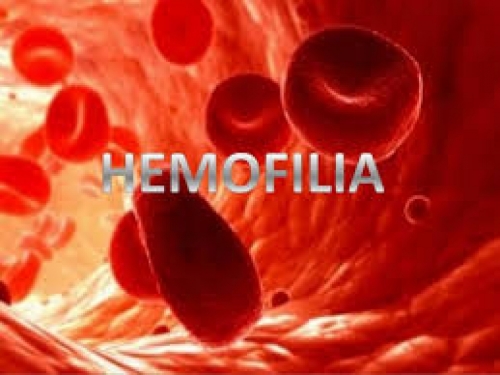 Znate li što je hemofilija?