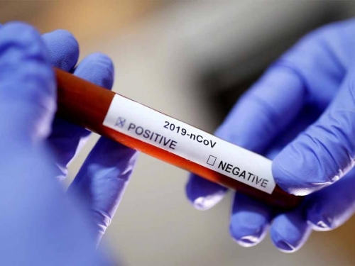 U Hercegovini još šest osoba zaražereno koronavirusom