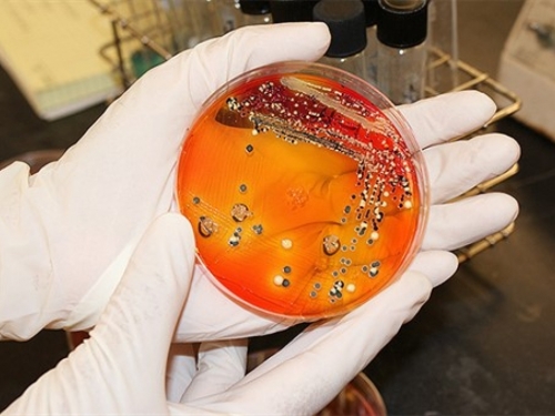 Bakterije sve otpornije na antibiotike
