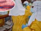 Ebola: Napadnuta bolnica, svi zaraženi razbježali se po glavnom gradu