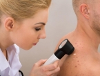 Raste broj muškaraca umrlih od raka kože