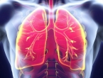 Koji su to simptomi upale pluća i tko je najugroženiji