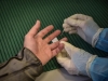 WHO: Virus hepatitisa dnevno ubije 3500 ljudi