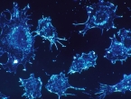 Otkrili nanočestice koje ubijaju karcinom bez kemoterapije