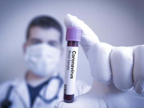 Koronavirus u BiH: Još 83 novozaraženo, preminulo 14 osoba