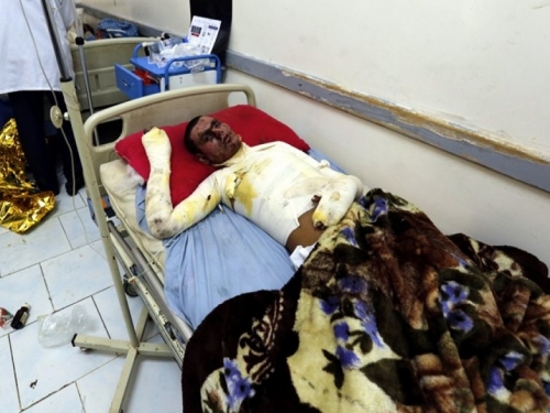 U zračnim napadima na jemensku luku najmanje 26 mrtvih