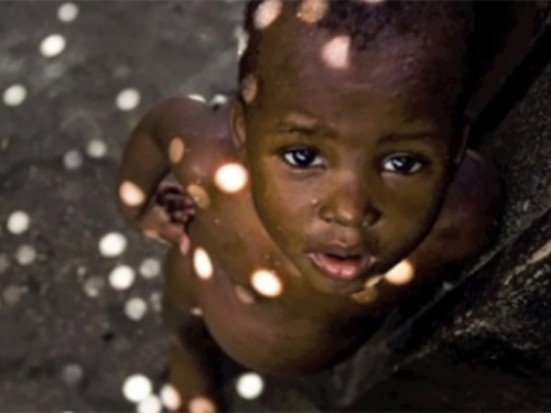UN: 90 posto djece zaraženo AIDS-om živi u Africi