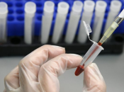 Predstavljen novi test krvi koji može otkriti 50 vrsta karcinoma prije pojave simptoma