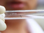 Zika virus stigao u Europu