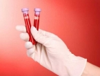 Znanstvenici korak bliže univerzalnom testu krvi za otkrivanje raka
