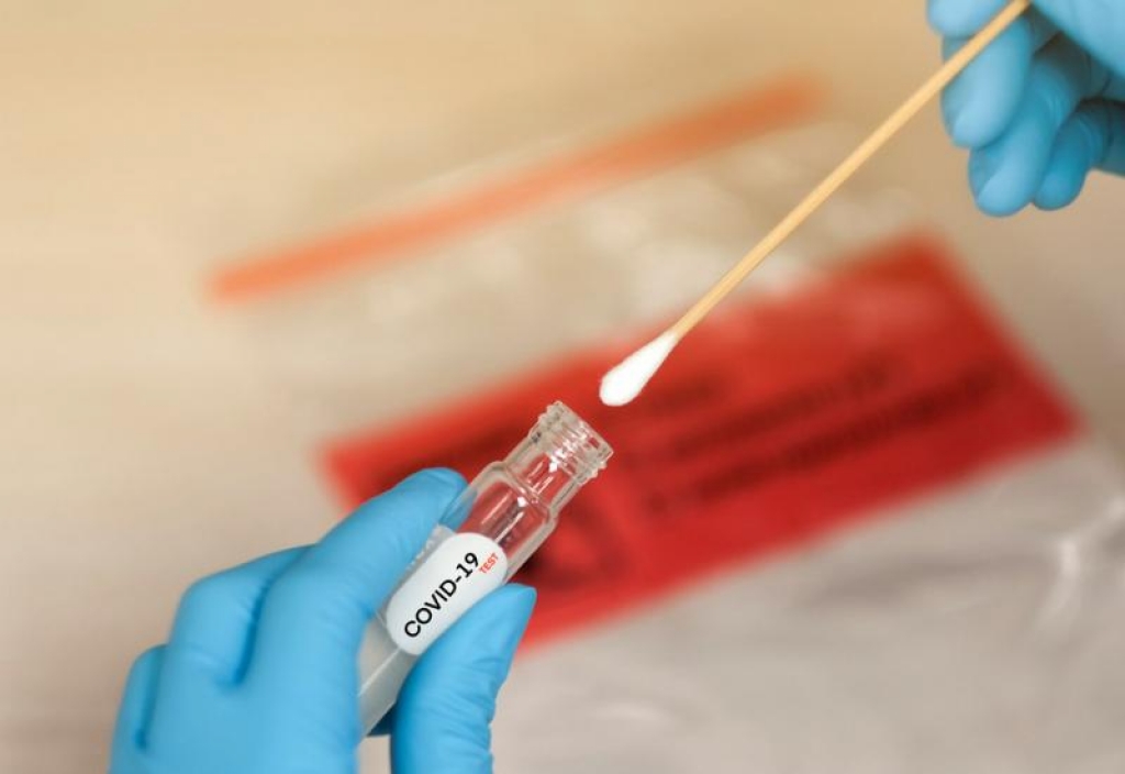 HNŽ: 39 osoba pozitivno, testirano 540